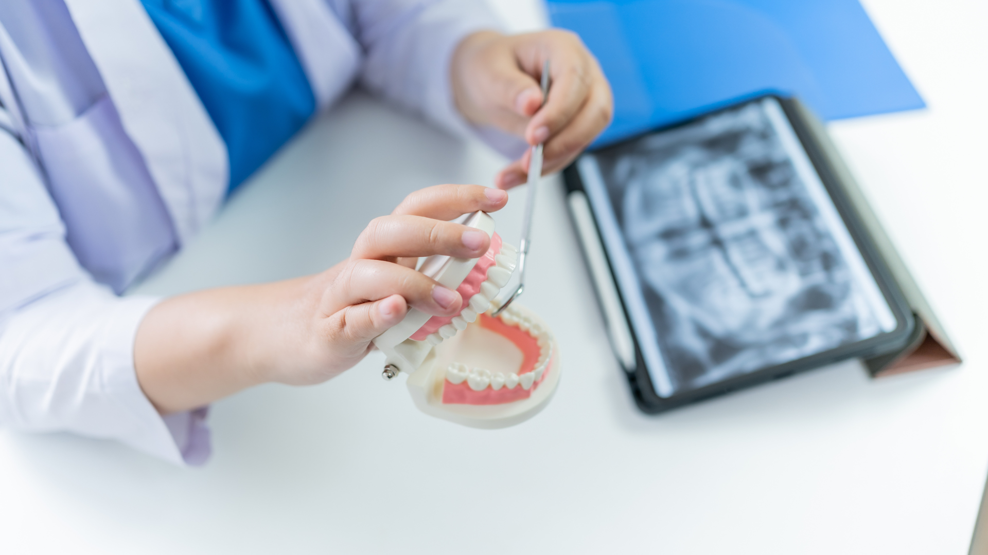 Why Preventative Dental Care is Essential: Insights from a Rockland, NY Dentist