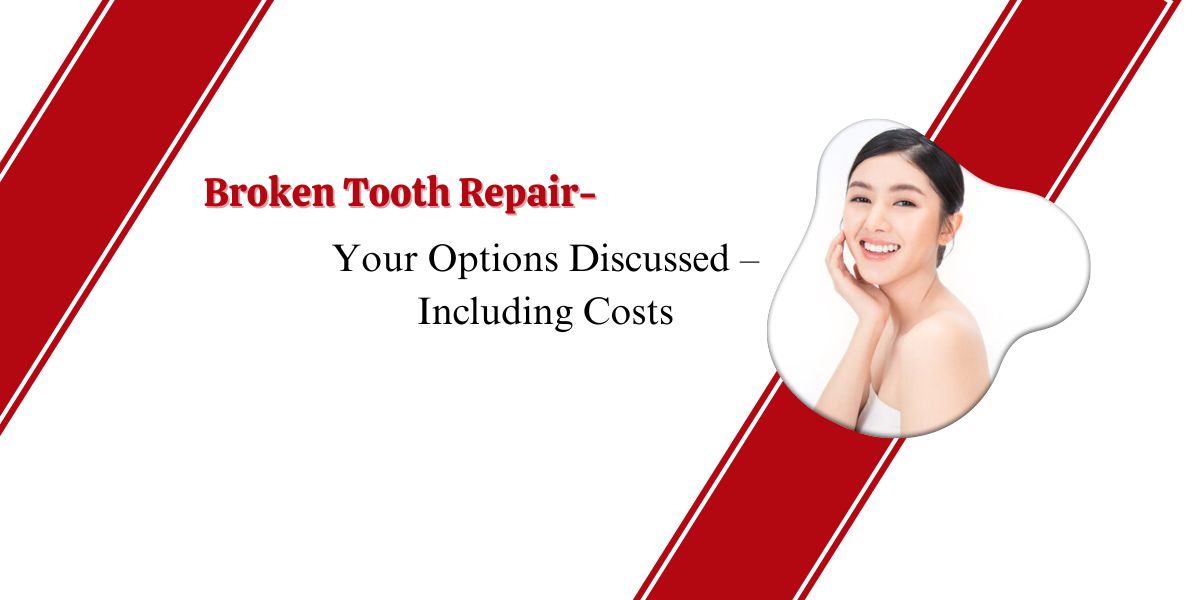 Broken-Tooth-Repair-–-Your-Options-Discussed-–-Including-Costs