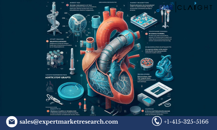 Europe Aortic Stent Graft Market: Projected Growth, Key Players 2024-2032