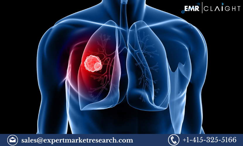 Lung Cancer Screening Market