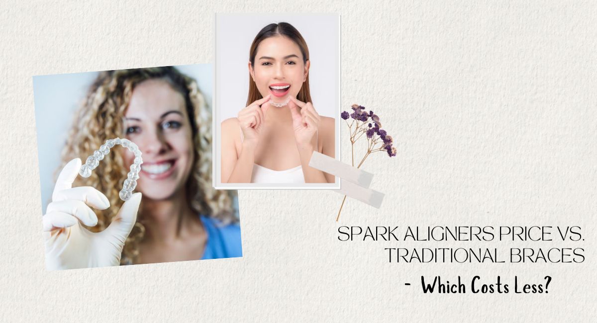 Spark Aligners London cost