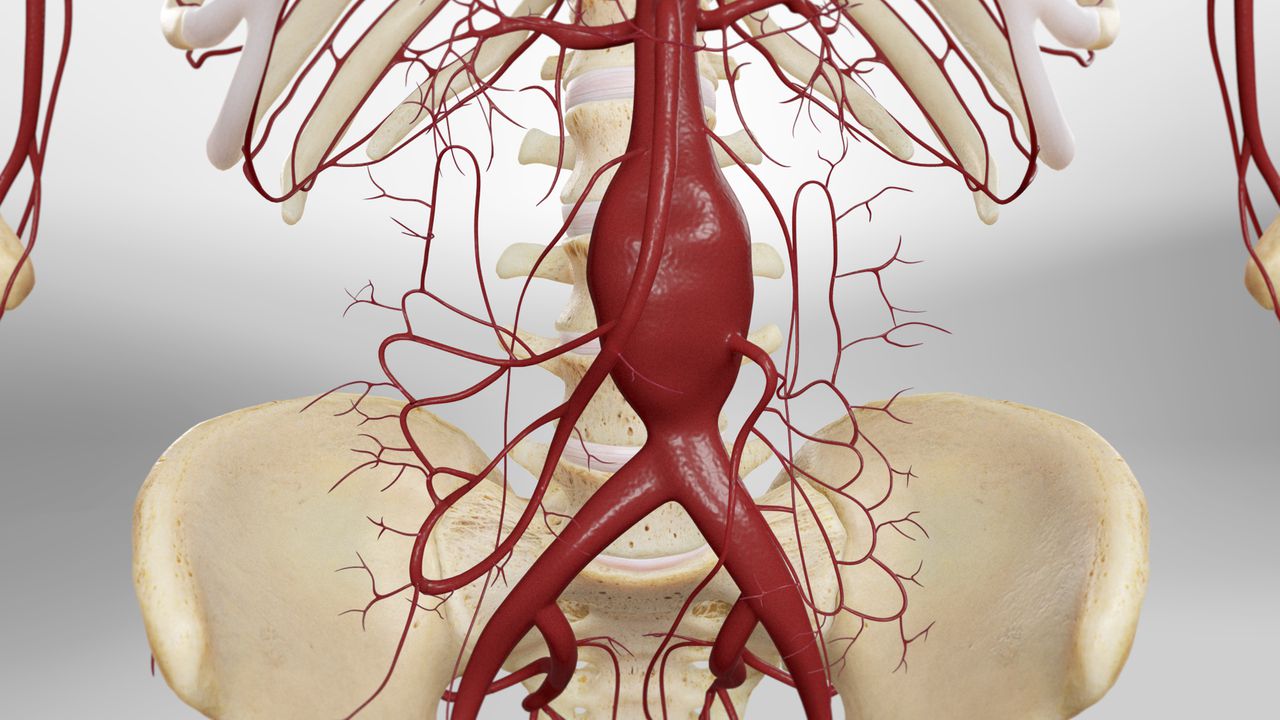 North America Aortic Stent Graft Market