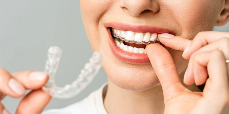 Your Journey to a Perfect Smile Begins at Miami Dental Offices