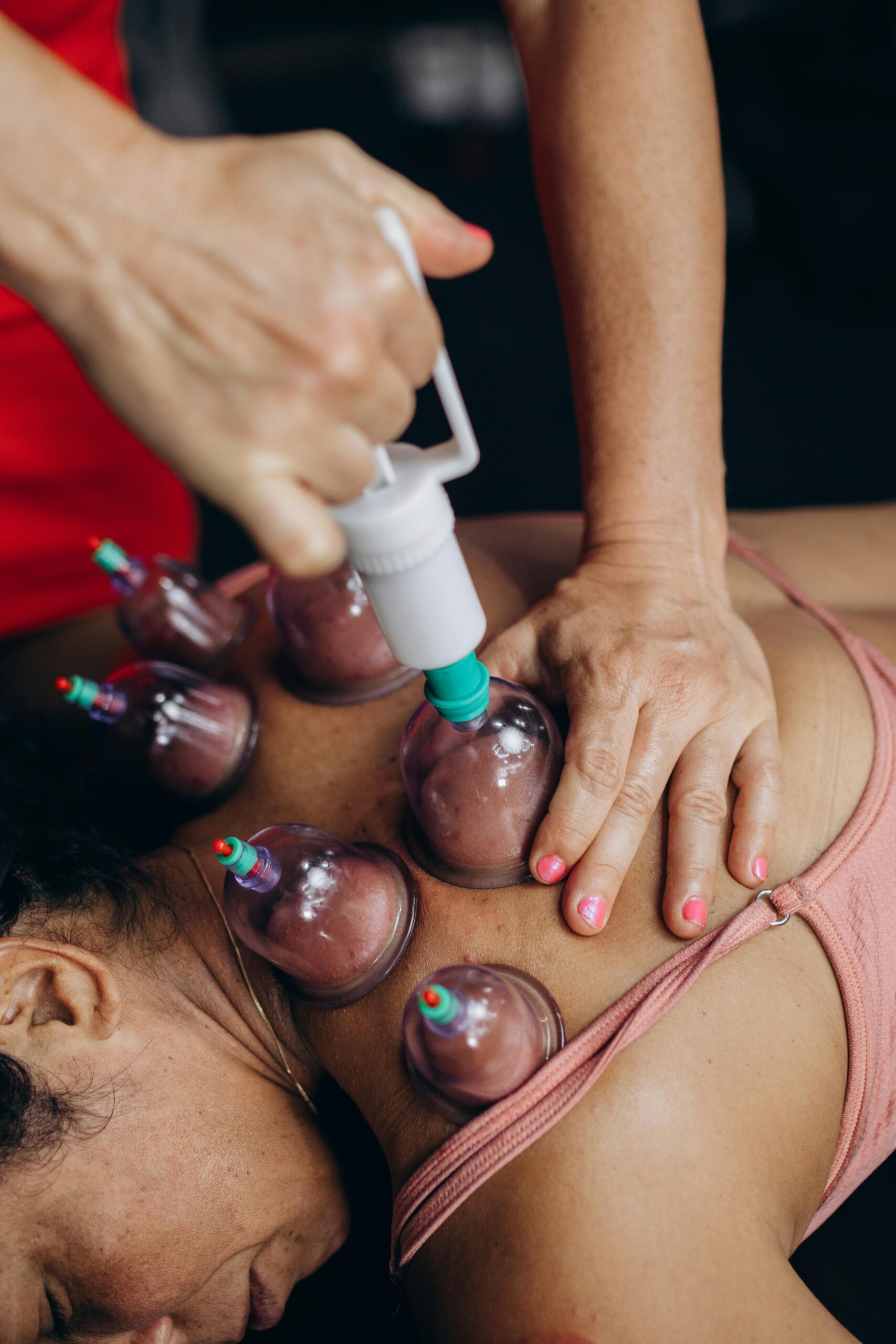 Hijama: A Comprehensive Guide to Benefits and Side Effects