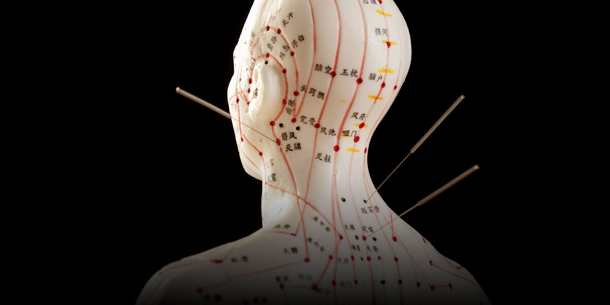 What is the Difference Between Acupuncture and Chinese Acupuncture?