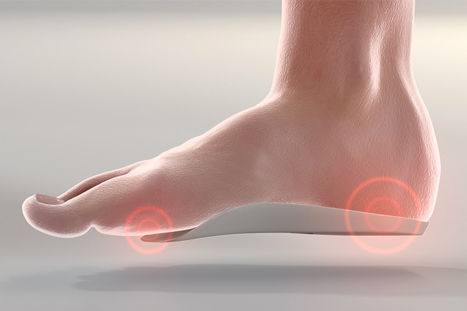 Problems with a High Arch Foot – Find Relief Today