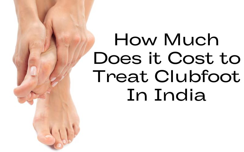 How Much Does it Cost to Treat Clubfoot In India?